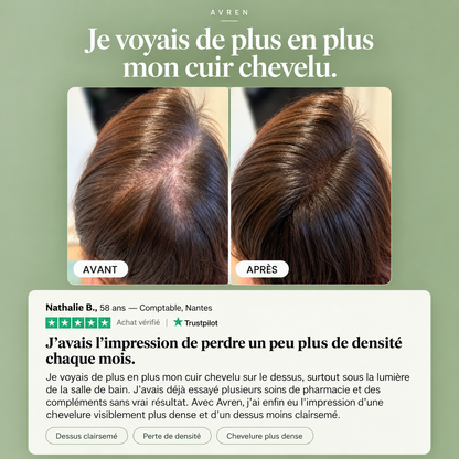 Avren Spray Densité — Cheveux affinés & perte de densité